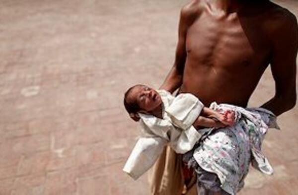 La malnutrition et les retards de croissance touche plus de 180 millions
d'enfants de moins de 5 ans dans le monde. ©REUTERS/Damir Sagolj