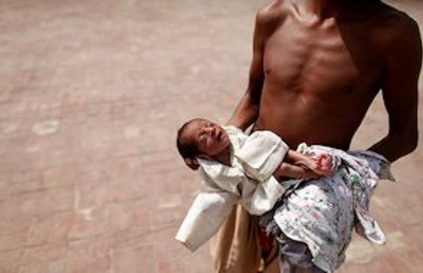 Malnutrition and stunting affect